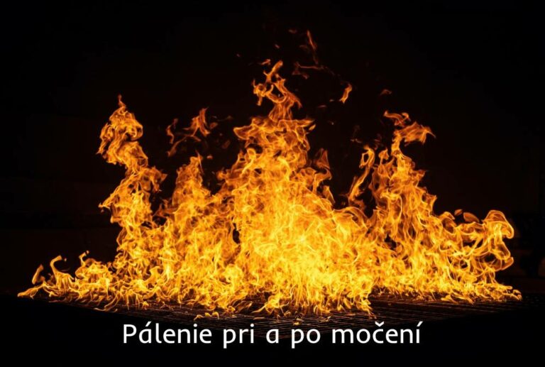 pálenie pri a po močení