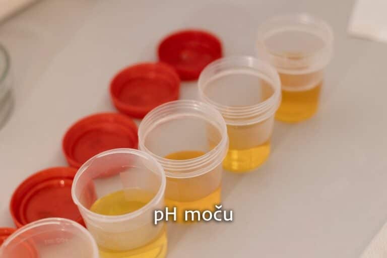 pH moču
