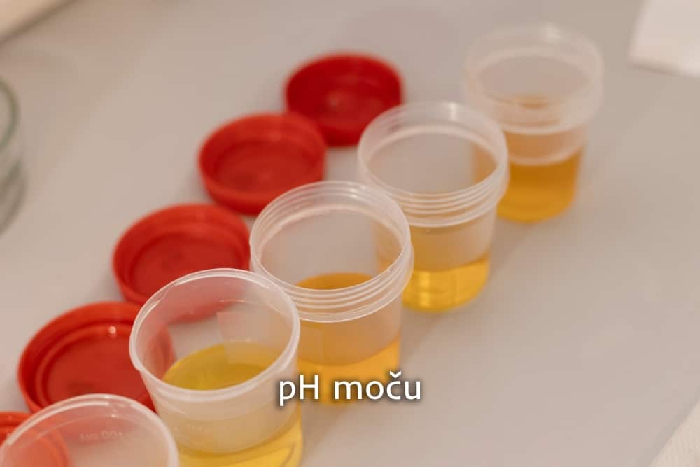 pH moču