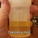 Zakalený moč
