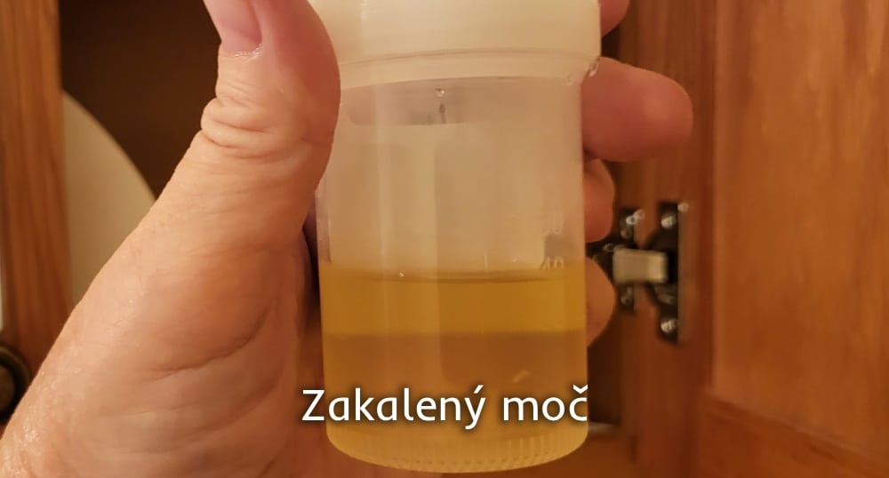 Zakalený moč