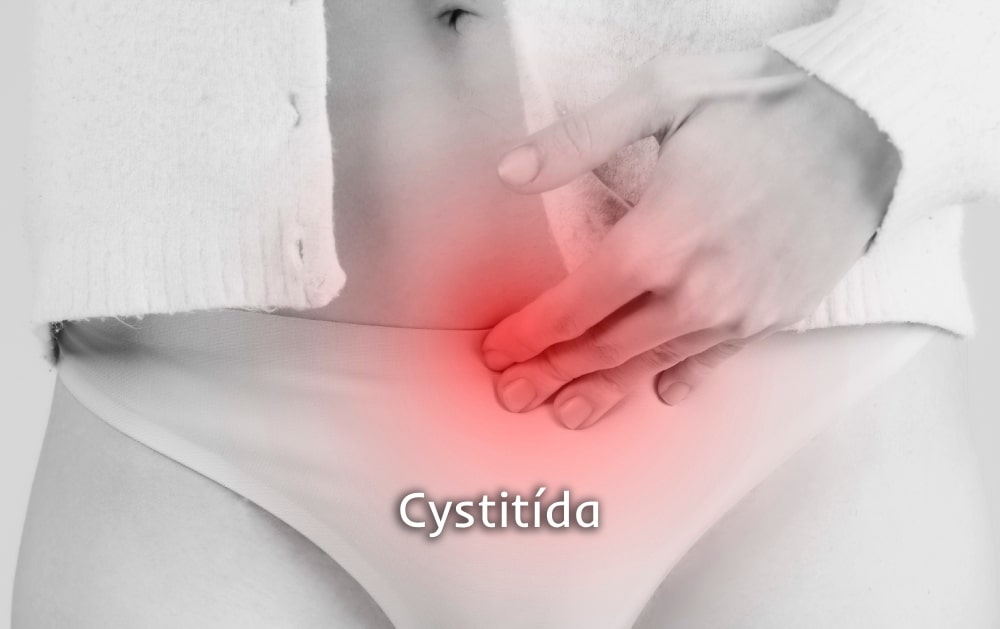 cystitída řešenie